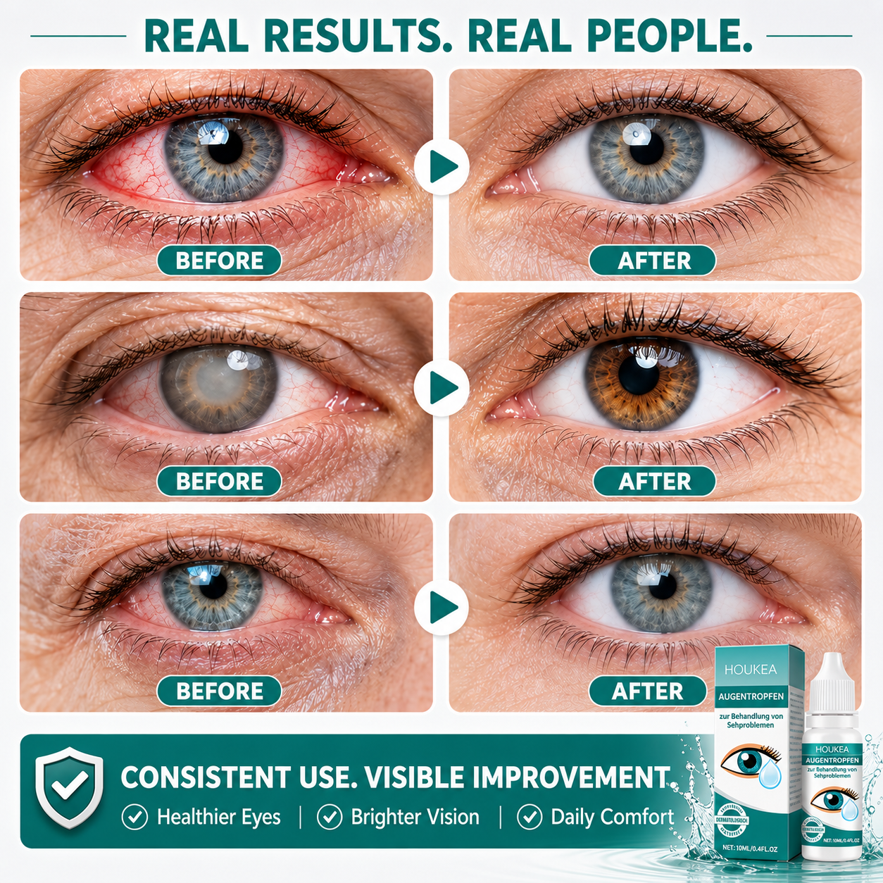 Professional Ophthalmic Care Eye Drops – Advanced Hydration for Dry, Irritated & Tired Eyes  -$AC