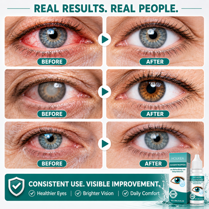 Professional Ophthalmic Care Eye Drops – Advanced Hydration for Dry, Irritated & Tired Eyes  -$AC
