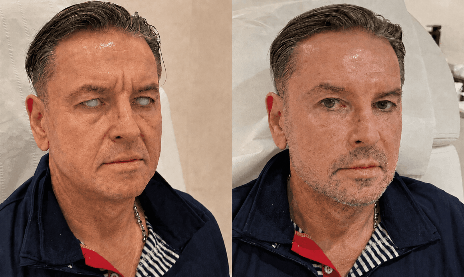 Male customer visual result