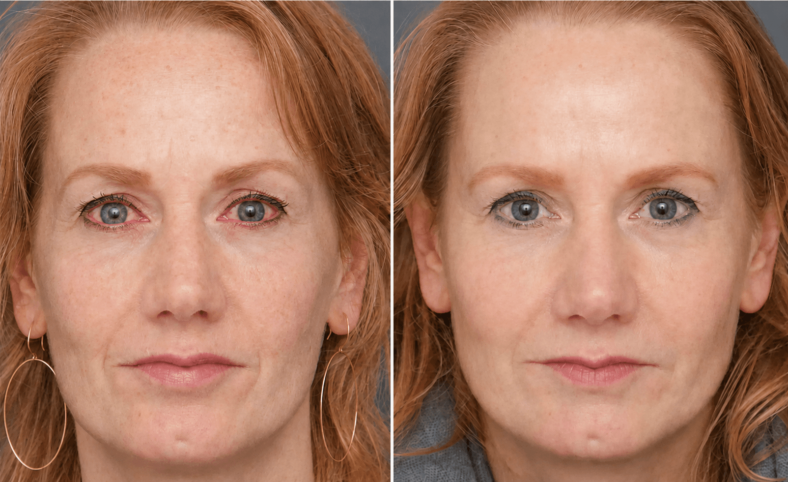 Female customer visual result