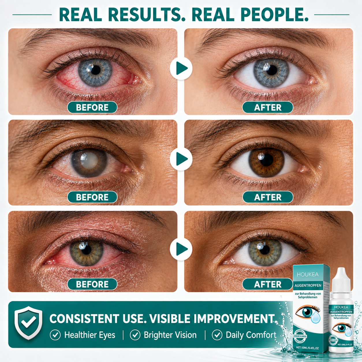 Adult eye comfort before and after examples