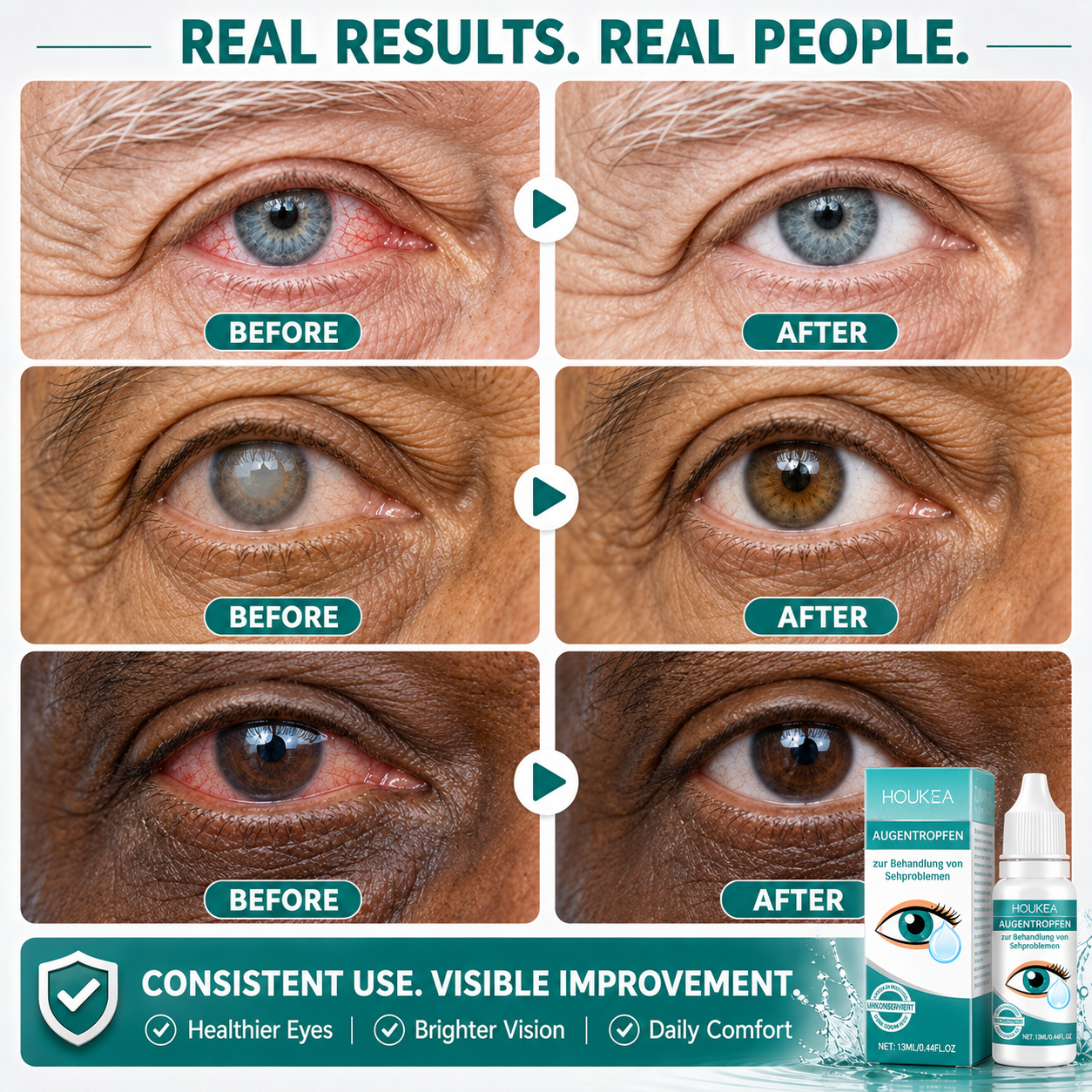 Senior eye comfort before and after examples