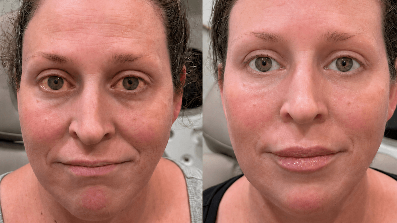 Redness appearance customer result