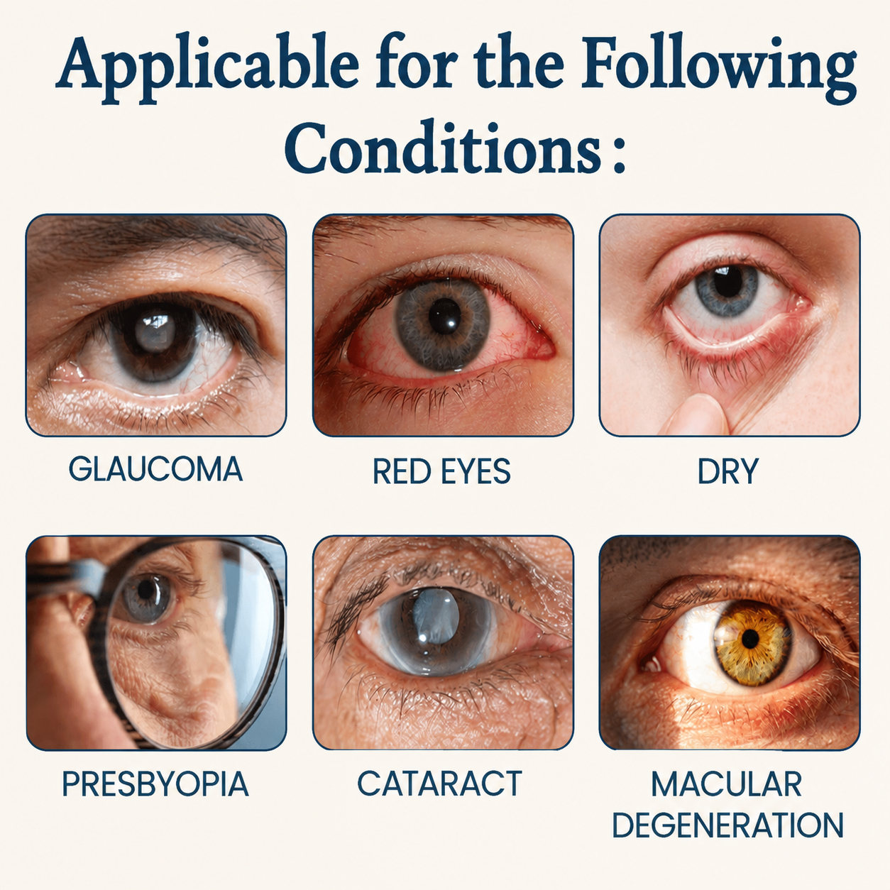 Overview of common eye conditions